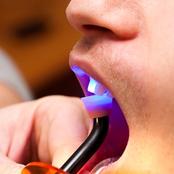 dentist using hardening light 